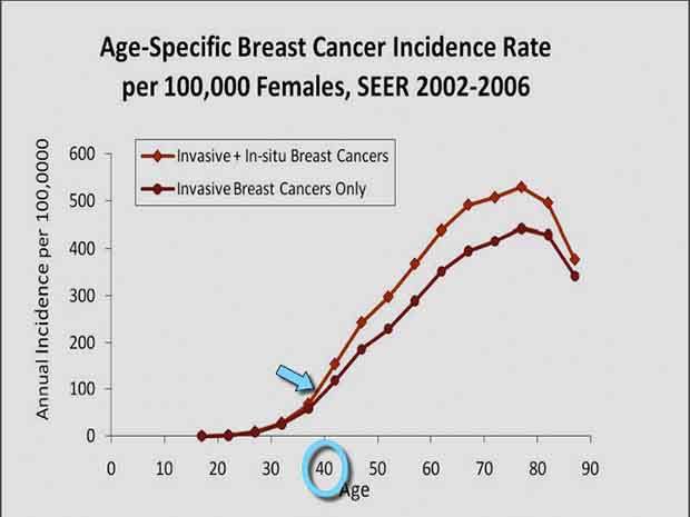 Breast cancer climbs at a steady rate for women in the United States