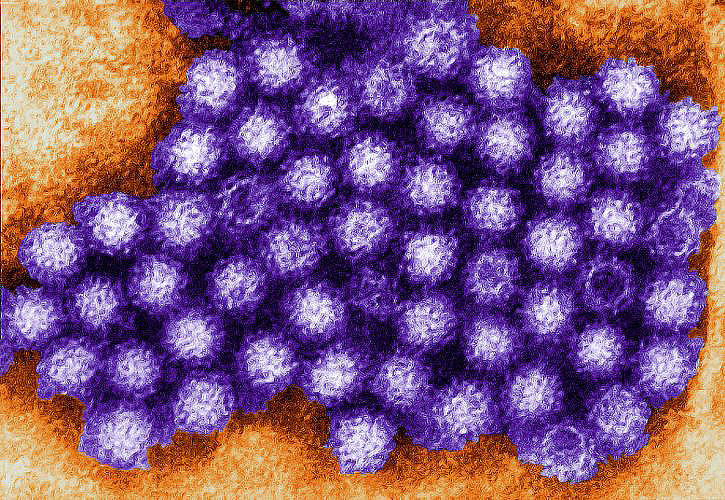 Noroviruses belong to the genus norovirus and the family caliciviridae. Charles D. Humphrey, USCDCP/ Pixnio.com